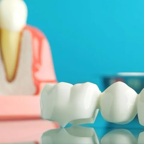 Ceramic dental bridge resting on a surface beside a tooth model