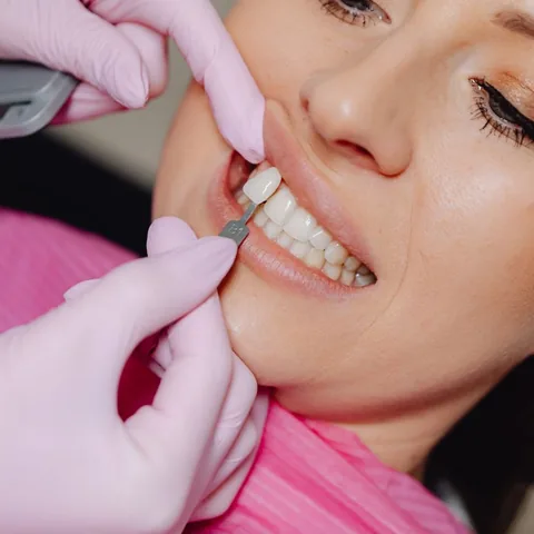 Dentist trying a porcelain veneer against a patient's front teeth