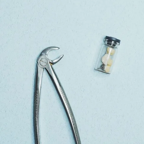 Extraction forceps beside a removed wisdom tooth in a specimen jar